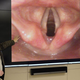 Illustration for article titled Scientists Find Human Vocal Cords Developed Over Millennia To Lower Voice When Speculating On Acquaintance’s Sexual Orientation